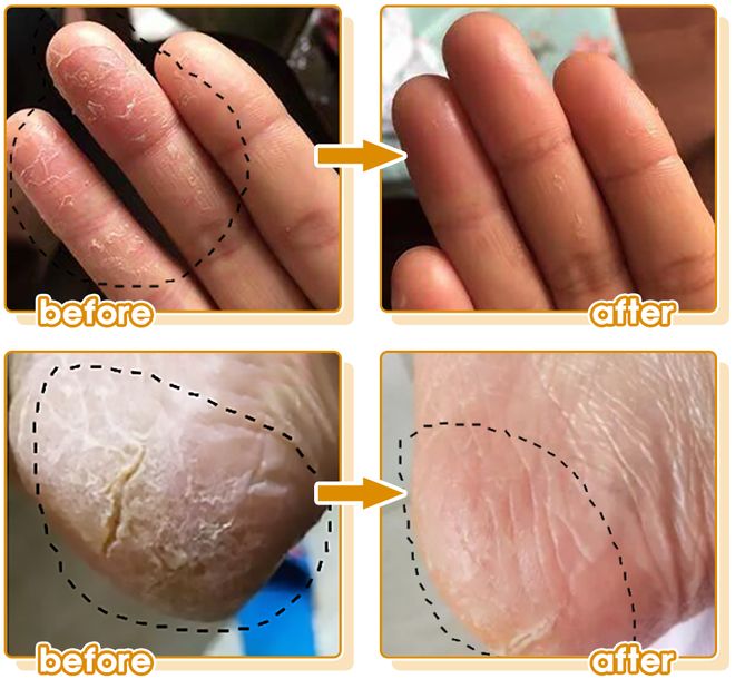 博士研发的身体乳“学霸”成分抹了!pg电子娱乐平台干到发痒?一群清华(图20) 博士研发的身体乳“学霸”成分抹了!pg电子娱乐平台干到发痒?一群清华(图20)